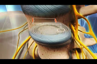 Vista del interior de un disco intervertebral. Imagen Health-spine