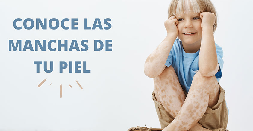 Conoce las manchas de tu piel Quiropráctico badalona