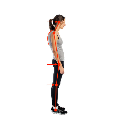 Análisis Postural